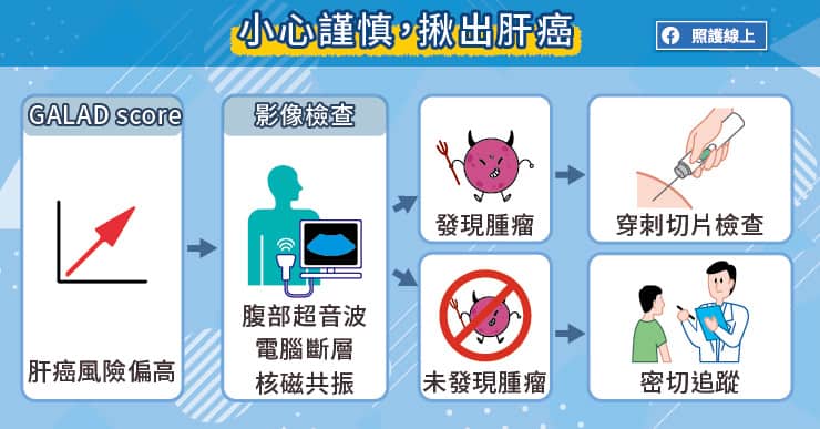 小心謹慎,揪出肝癌