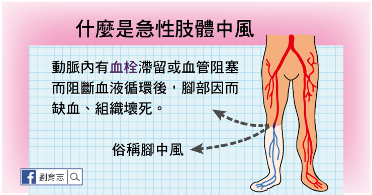 中風