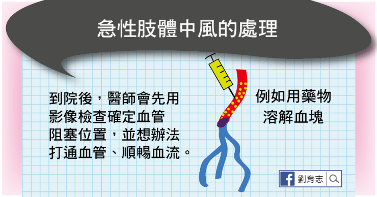中風
