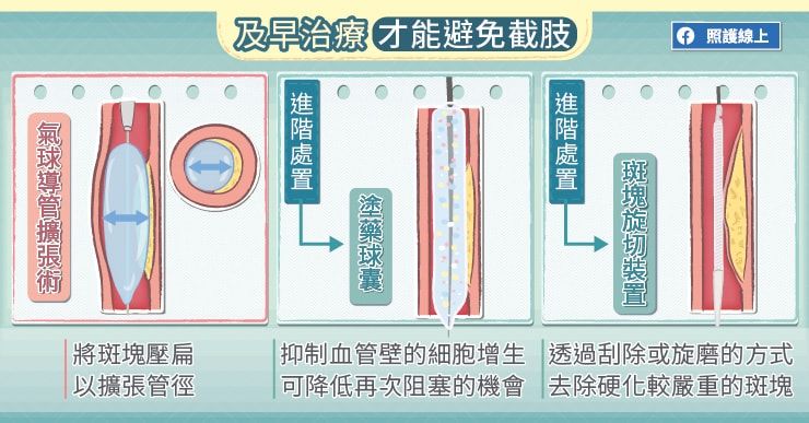 傷口