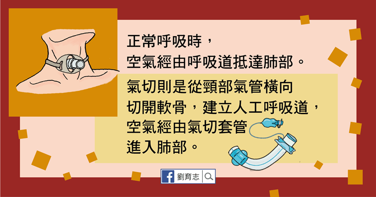 氣切