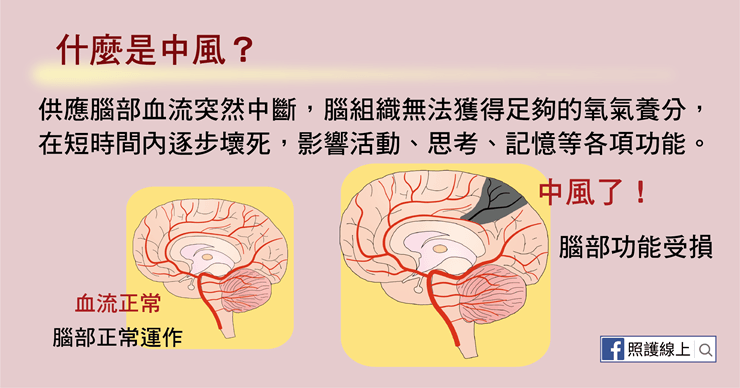 中風