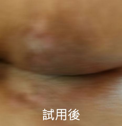 試用者實拍