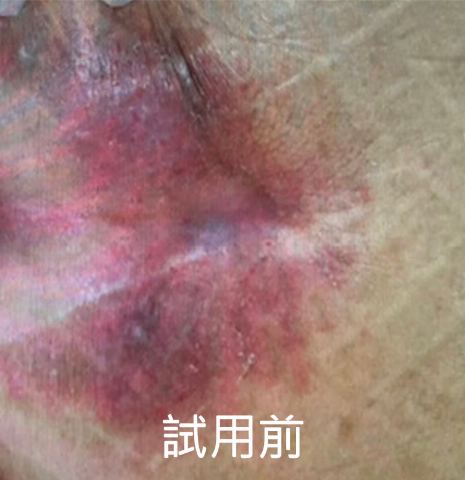試用者實拍